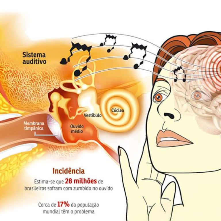 blog-prevencao-ao-zumbido-e-possivel-evitar